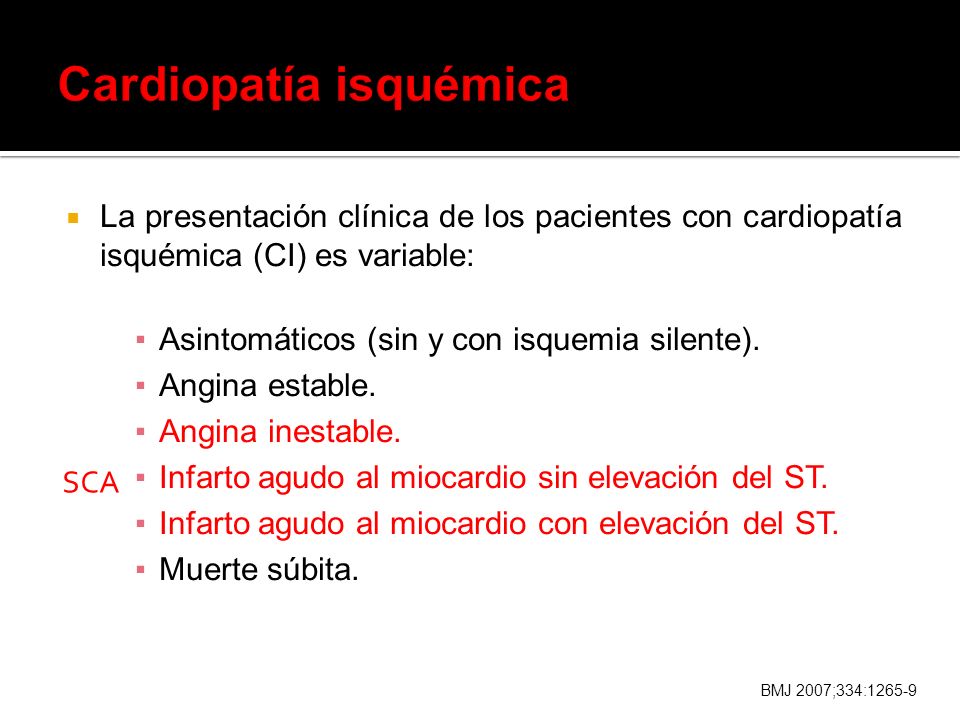 isquemia silente del miocardio